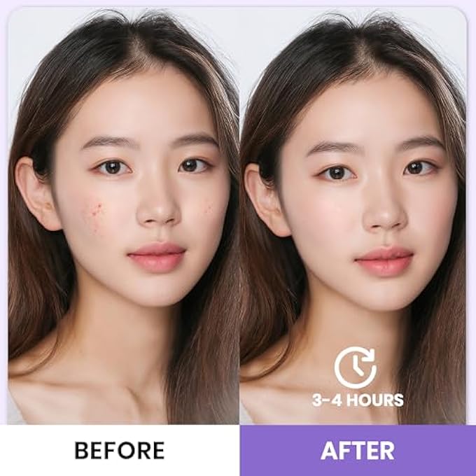 ZypplyPro قناع الوجه بالكولاجين العميق 5 عبوات، قناع الوجه المرطب البيوكولاجين للعناية ببشرة النساء، قناع ورقي كوري مضاد للتجاعيد للاستخدام الليلي بوزن جزيئي منخفض لرفع وشد وترطيب البشرة، 28 جرام × 4 عبوات - Image 4